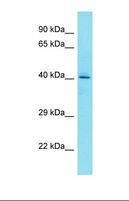 HGH1 / FAM203A Antibody - Western blot of HepG2. FAM203A antibody dilution 1.0 ug/ml.  This image was taken for the unconjugated form of this product. Other forms have not been tested.