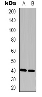 HGH1 / FAM203A Antibody - Western blot analysis of FAM203A expression in HeLa (A); Colo320 (B) whole cell lysates.