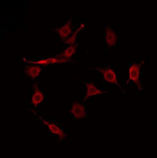 HGH1 / FAM203A Antibody - Staining COLO205 cells by IF/ICC. The samples were fixed with PFA and permeabilized in 0.1% Triton X-100, then blocked in 10% serum for 45 min at 25°C. The primary antibody was diluted at 1:200 and incubated with the sample for 1 hour at 37°C. An Alexa Fluor 594 conjugated goat anti-rabbit IgG (H+L) Ab, diluted at 1/600, was used as the secondary antibody.