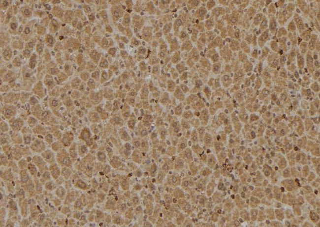 HGH1 / FAM203A Antibody - 1:100 staining mouse liver tissue by IHC-P. The sample was formaldehyde fixed and a heat mediated antigen retrieval step in citrate buffer was performed. The sample was then blocked and incubated with the antibody for 1.5 hours at 22°C. An HRP conjugated goat anti-rabbit antibody was used as the secondary.