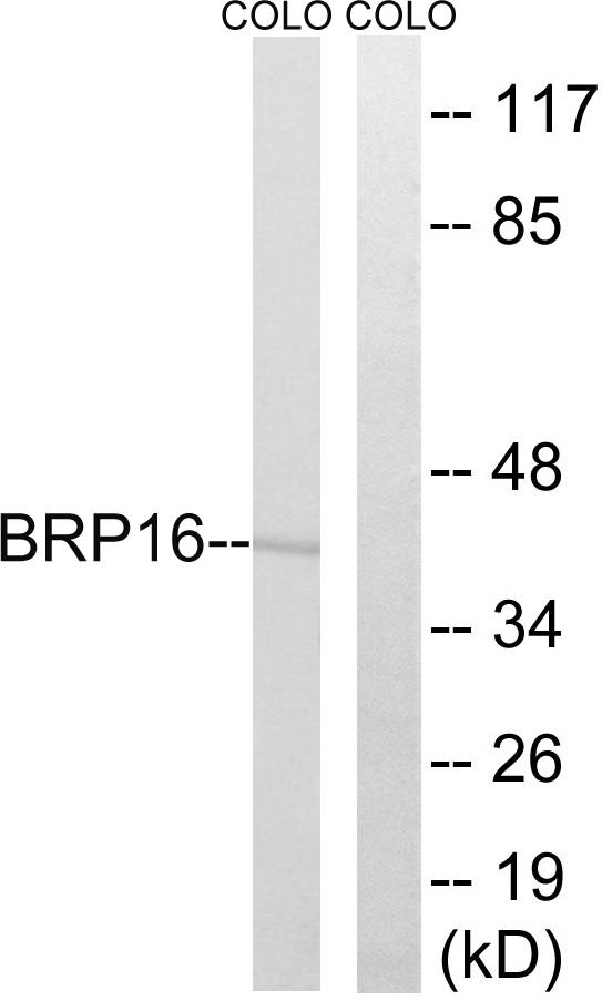 HGH1 / FAM203A Antibody - Western blot analysis of extracts from COLO cells, using BRP16 antibody.