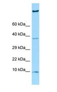 HGSNAT Antibody - HGSNAT antibody Western Blot of OVCAR-3.  This image was taken for the unconjugated form of this product. Other forms have not been tested.