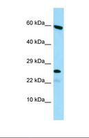 HGSNAT Antibody - Western blot of Human HepG2. HGSNAT antibody dilution 1.0 ug/ml.  This image was taken for the unconjugated form of this product. Other forms have not been tested.