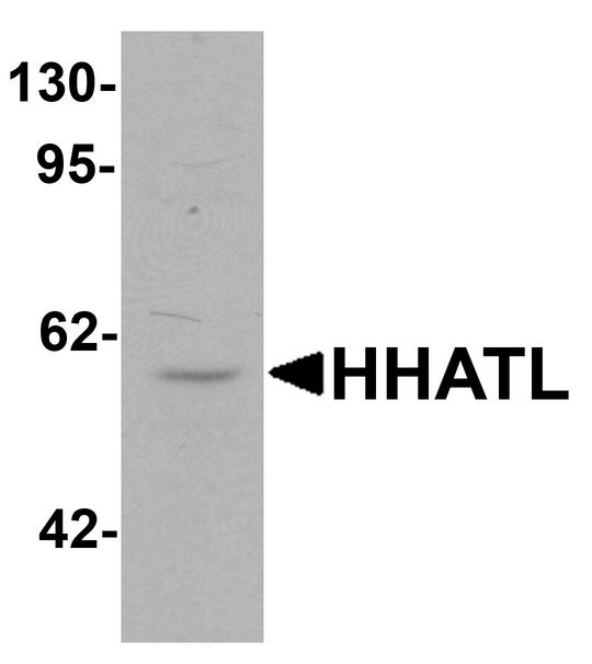 HHATL Antibody - Western blot analysis of HHATL in 3T3 cell lysate with HHATL antibody at 1 ug/ml.