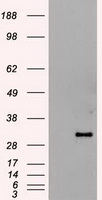 HHEX / HEX Antibody - HEK293T cells were transfected with the pCMV6-ENTRY control (Left lane) or pCMV6-ENTRY HHex (Right lane) cDNA for 48 hrs and lysed. Equivalent amounts of cell lysates (5 ug per lane) were separated by SDS-PAGE and immunoblotted with anti-HHex.