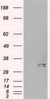 HHEX / HEX Antibody - HEK293T cells were transfected with the pCMV6-ENTRY control (Left lane) or pCMV6-ENTRY HHex (Right lane) cDNA for 48 hrs and lysed. Equivalent amounts of cell lysates (5 ug per lane) were separated by SDS-PAGE and immunoblotted with anti-HHex.