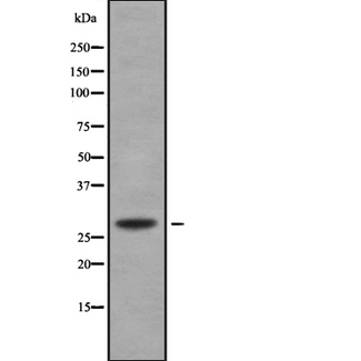 HHEX / HEX Antibody - Western blot analysis of HHEX using HeLa whole lysates.