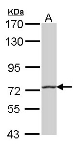 HHIP / HIP Antibody - Sample (30 ug of whole cell lysate). A: A431 . 7.5% SDS PAGE. HHIP / HIP antibody diluted at 1:1000.
