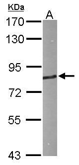 HHIP / HIP Antibody - Sample (50 ug of whole cell lysate). A: Mouse brain. 7.5% SDS PAGE. HHIP / HIP antibody diluted at 1:1000.