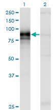 HHIP / HIP Antibody - Western blot of HHIP expression in transfected 293T cell line by HHIP monoclonal antibody (M01), clone 5D11.