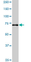HHIP / HIP Antibody - HHIP monoclonal antibody (M01), clone 5D11. Western blot of HHIP expression in MCF-7.