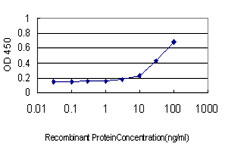 HHIP / HIP Antibody - Detection limit for recombinant GST tagged HHIP is approximately 1 ng/ml as a capture antibody.