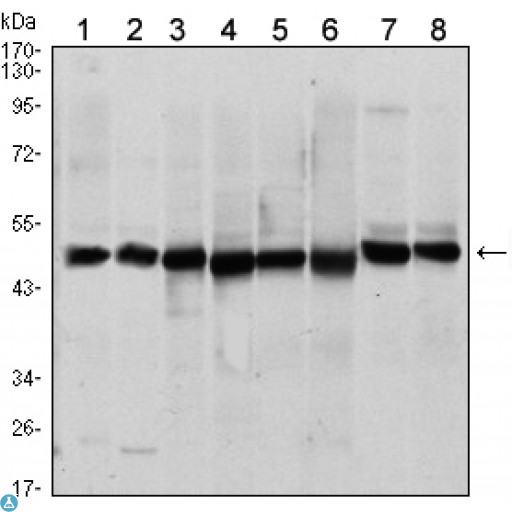HHIP / HIP Antibody - Western Blot (WB) analysis using Hip Monoclonal Antibody against A431 (1), HEK293 (2), HeLa (3), HepG2 (4), Jurkat (5), K562 (6), L121O (7) and MCF-7 (8) cell lysate.