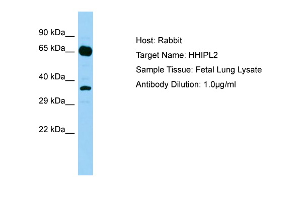 HHIPL2 Antibody -  This image was taken for the unconjugated form of this product. Other forms have not been tested.