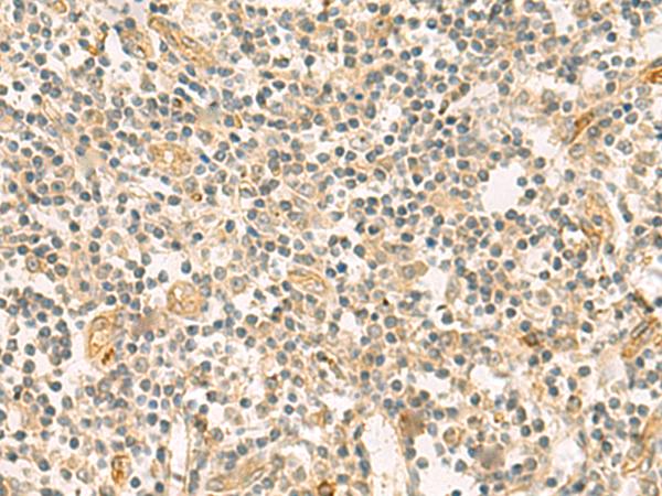 HHIPL2 Antibody - Immunohistochemistry of paraffin-embedded Human tonsil tissue  using HHIPL2 Polyclonal Antibody at dilution of 1:55(×200)