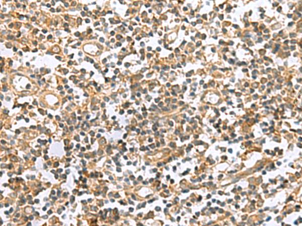 HHIPL2 Antibody - Immunohistochemistry of paraffin-embedded Human tonsil tissue  using HHIPL2 Polyclonal Antibody at dilution of 1:50(×200)