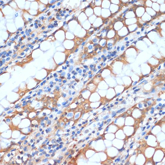 HHLA2 Antibody - Immunohistochemistry of paraffin-embedded Human colon using HHLA2 Polyclonal Antibody at dilution of 1:100 (40x lens).