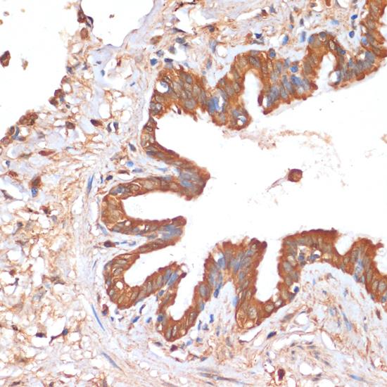 HHLA2 Antibody - Immunohistochemistry of paraffin-embedded Human lung using HHLA2 Polyclonal Antibody at dilution of 1:100 (40x lens).