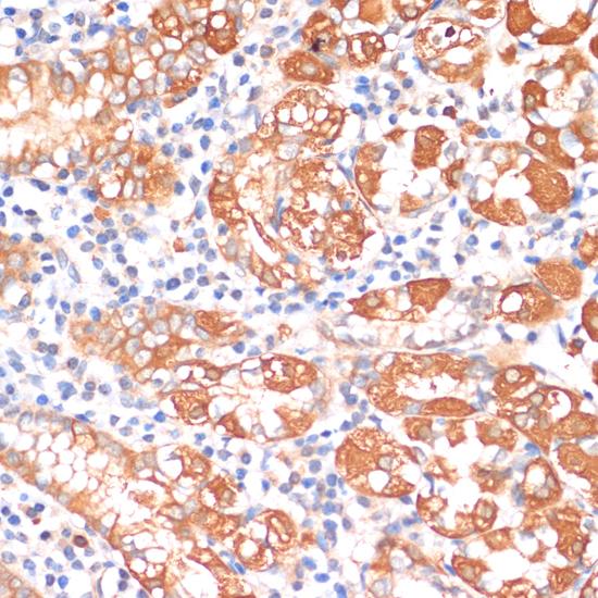 HHLA2 Antibody - Immunohistochemistry of paraffin-embedded Human stomach using HHLA2 Polyclonal Antibody at dilution of 1:100 (40x lens).