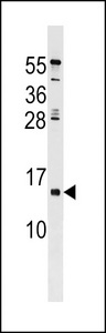 HHLA3 Antibody - HHLA3 Antibody western blot of HeLa cell line lysates (35 ug/lane). The HHLA3 antibody detected the HHLA3 protein (arrow).