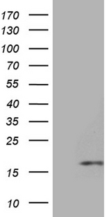 HHLA3 Antibody - HEK293T cells were transfected with the pCMV6-ENTRY control. (Left lane) or pCMV6-ENTRY HHLA3. (Right lane) cDNA for 48 hrs and lysed. Equivalent amounts of cell lysates. (5 ug per lane) were separated by SDS-PAGE and immunoblotted with anti-HHLA3. (1:500)