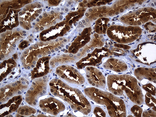 HHLA3 Antibody - Immunohistochemical staining of paraffin-embedded Human Kidney tissue within the normal limits using anti-HHLA3 mouse monoclonal antibody. (Heat-induced epitope retrieval by 1mM EDTA in 10mM Tris buffer. (pH8.5) at 120°C for 3 min. (1:500)