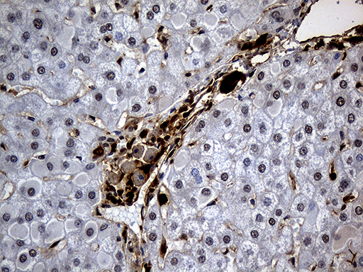 HHLA3 Antibody - Immunohistochemical staining of paraffin-embedded Human liver tissue within the normal limits using anti-HHLA3 mouse monoclonal antibody. (Heat-induced epitope retrieval by 1mM EDTA in 10mM Tris buffer. (pH8.5) at 120°C for 3 min. (1:500)