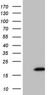 HHLA3 Antibody - HEK293T cells were transfected with the pCMV6-ENTRY control. (Left lane) or pCMV6-ENTRY HHLA3. (Right lane) cDNA for 48 hrs and lysed. Equivalent amounts of cell lysates. (5 ug per lane) were separated by SDS-PAGE and immunoblotted with anti-HHLA3. (1:2000)