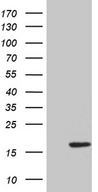 HHLA3 Antibody - HEK293T cells were transfected with the pCMV6-ENTRY control. (Left lane) or pCMV6-ENTRY HHLA3. (Right lane) cDNA for 48 hrs and lysed. Equivalent amounts of cell lysates. (5 ug per lane) were separated by SDS-PAGE and immunoblotted with anti-HHLA3. (1:500)