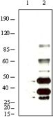 HHV-8 K8 alpha Antibody - KSHV K8a Antibody in Western Blot (WB)