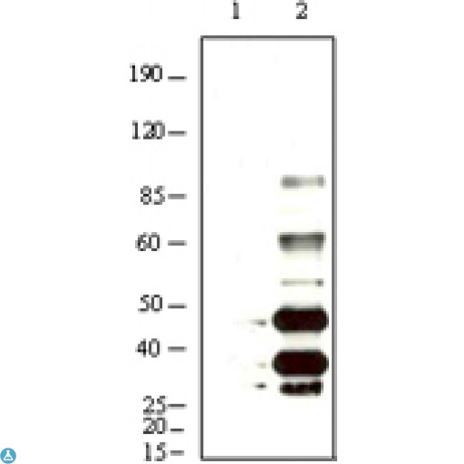 HHV-8 K8 alpha Antibody - Western Blot (WB) analysis using KSHV K8alpha Monoclonal Antibody against BCBL-1 (1) and TPA induced BCBL-1 (2) cell lysate.