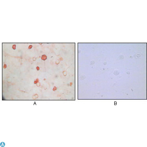 HHV-8 K8 alpha Antibody - Immunocytochemistry (ICC) analysis of TPA induced BCBL-1 cells (A) and uninduced BCBL-1 cells (B) using KSHV K8alpha Monoclonal Antibody with AEC staining.