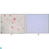 HHV-8 K8 alpha Antibody - Immunocytochemistry (ICC) analysis of TPA induced BCBL-1 cells (A) and uninduced BCBL-1 cells (B) using KSHV K8alpha Monoclonal Antibody with AEC staining.