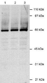 HHV-8 LANA-2 Antibody - Detection of LANA2 in infected lysates (30 ug) using antibody at 2 ug/ml. ECL detection 1.5 minutes. Lane 1: BCBL-1 (KSHV+), Lane 2: BC-1 (KSHV+/EBV+), Lane 3: BCP-1 (KSHV+).  This image was taken for the unconjugated form of this product. Other forms have not been tested.