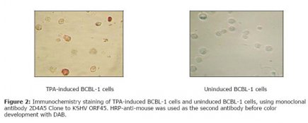 HHV-8 ORF45 Antibody