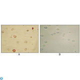HHV-8 ORF45 Antibody - Immunocytochemistry (ICC) analysis of TPA induced BCBL-1 cells (A) and uninduced BCBL-1 cells (B) using KSHV ORF45 Monoclonal Antibody with AEC staining.