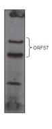 HHV-8 ORF57 Antibody - KSHV ORF 57 Antibody western blot analysis Over-expressed GFP-tagged ORF57 in HEK293T cell line.