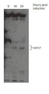 HHV-8 ORF57 Antibody - KSHV ORF 57 Antibody western blot analysis. ORF57 expressed from an inducible virally infected B-cell line, TREx BCBL 1-Rta.