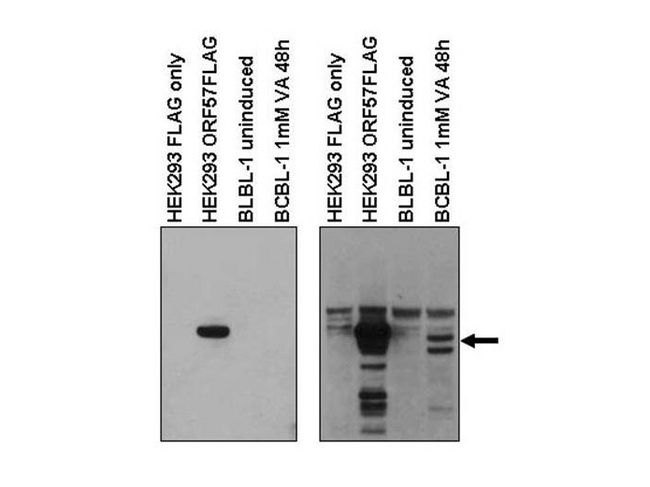 HHV-8 ORF57 Antibody - Anti-KSHV ORF57 Antibody - Western Blot. Western blot of affinity purified anti-KSHV ORF57 to detect KSHV ORF57 in HEK293 cells transfected with ORF57 expression vector and ORF57 truncations, or in KSHV infected B-cell line (BCBL-1) treated with or without valproic acid to induce viral replication (arrow). The membrane was probed with the primary antibody diluted 1:7500 (left) and 1:1000 (right). Personal Communication, V. Majerciak, M. Zheng, CCR-NCI, Bethesda, MD.
