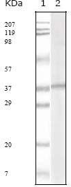 HHV-8 ORF62 Antibody - KSHV ORF62 Antibody in Western Blot (WB)