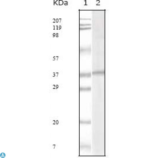 HHV-8 ORF62 Antibody - Western Blot (WB) analysis using KSHV ORF62 Monoclonal Antibody against KSHV ORF62 recombinant protein.