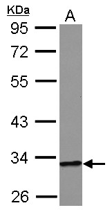 HIBADH Antibody - Sample (30 ug of whole cell lysate) A: A549 10% SDS PAGE HIBADH antibody diluted at 1:10000