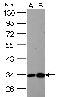 HIBADH Antibody - HIBADH antibody detects HIBADH protein by Western blot analysis.A. 30 ug Neuro2A whole cell lysate/extract. 30 ug C8D30 whole cell lysate/extract10 % SDS-PAGEHIBADH antibody  dilution: 1:5000