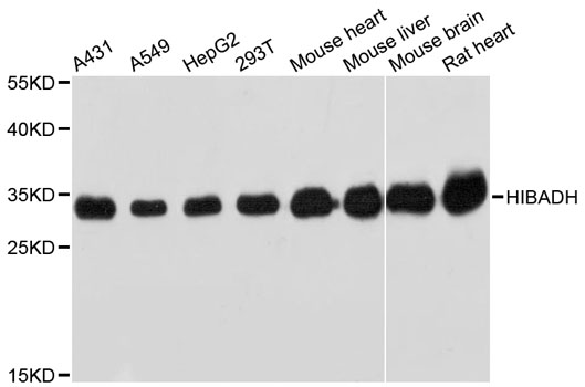 HIBADH Antibody - Western blot analysis of extracts of various cell lines, using HIBADH antibody at 1:3000 dilution. The secondary antibody used was an HRP Goat Anti-Rabbit IgG (H+L) at 1:10000 dilution. Lysates were loaded 25ug per lane and 3% nonfat dry milk in TBST was used for blocking. An ECL Kit was used for detection and the exposure time was 20s.