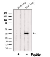 HIBADH Antibody - Western blot analysis of extracts of 3T3 cells using HIBADH antibody. The lane on the left was treated with blocking peptide.