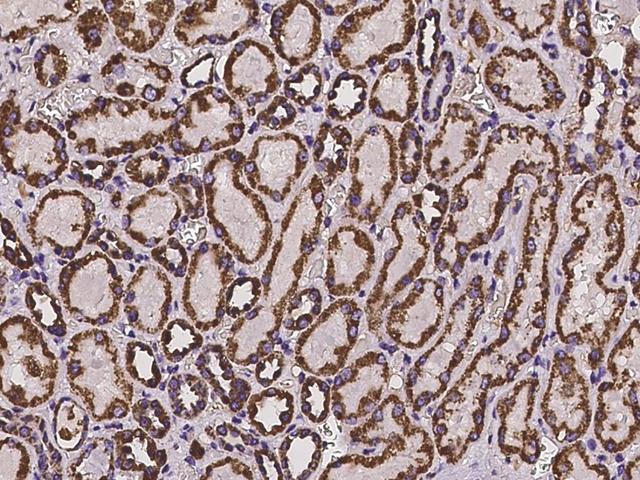HIBADH Antibody - Immunochemical staining of human HIBADH in human kidney with rabbit polyclonal antibody at 1:100 dilution, formalin-fixed paraffin embedded sections.