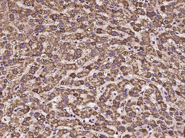 HIBADH Antibody - Immunochemical staining of human HIBADH in human liver with rabbit polyclonal antibody at 1:100 dilution, formalin-fixed paraffin embedded sections.