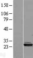 HIBADH Protein - Western validation with an anti-DDK antibody * L: Control HEK293 lysate R: Over-expression lysate