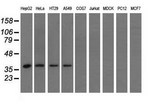 HIBCH Antibody - Western blot of extracts (35 ug) from 9 different cell lines by using anti-HIBCH monoclonal antibody.