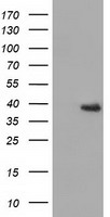 HIBCH Antibody - HEK293T cells were transfected with the pCMV6-ENTRY control (Left lane) or pCMV6-ENTRY HIBCH (Right lane) cDNA for 48 hrs and lysed. Equivalent amounts of cell lysates (5 ug per lane) were separated by SDS-PAGE and immunoblotted with anti-HIBCH.